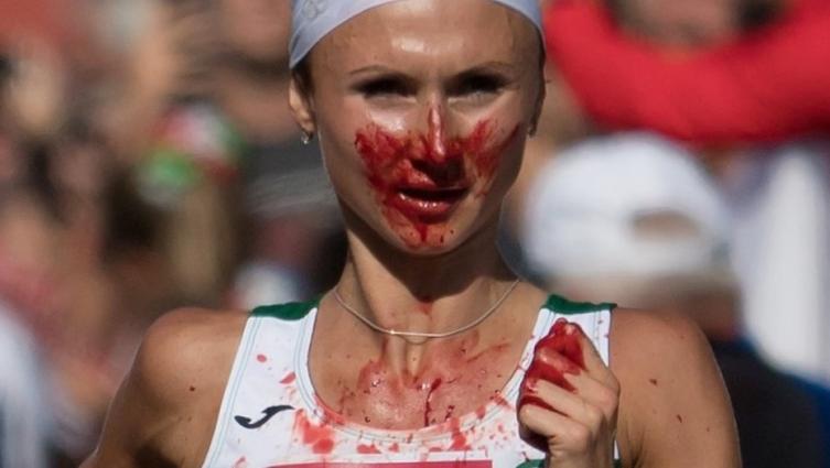 Volha Mazuronak sufrió una hemorragia nasal y ya nada fue igual (DPA).
