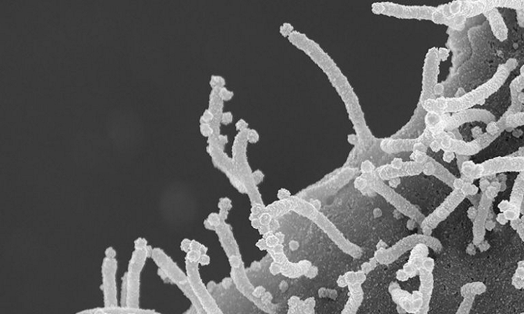 Imagen de microscopía electrónica de una célula infectada por el coronavirus que causa COVID-19 (UC San Francisco)