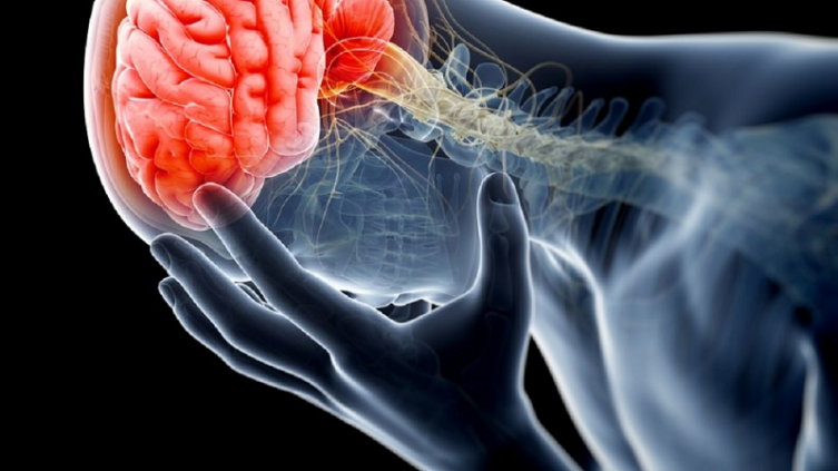 Lo que debes saber sobre el Accidente Cerebrovascular (ACV) - PRONTO