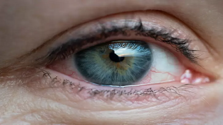 Qué es el glaucoma y cómo se previene - Foto: GETTY IMAGES