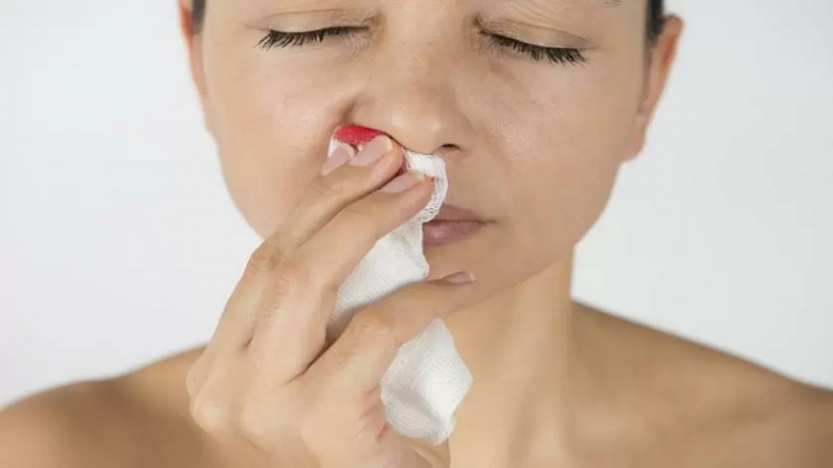 ¿Por qué sangra la nariz? Descubre si es grave y cómo actuar - Foto: ISTOCK