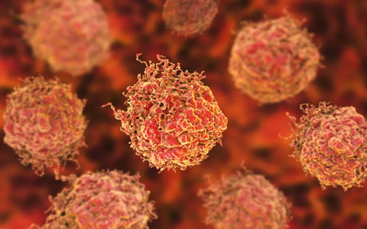 La investigación abre la puerta a desarrollar un nuevo tipo de detección de tumores graves con un análisis de orina. El trabajo fue publicado en la revista European Urology Oncology (IMPERIAL COLLEGE LONDON)