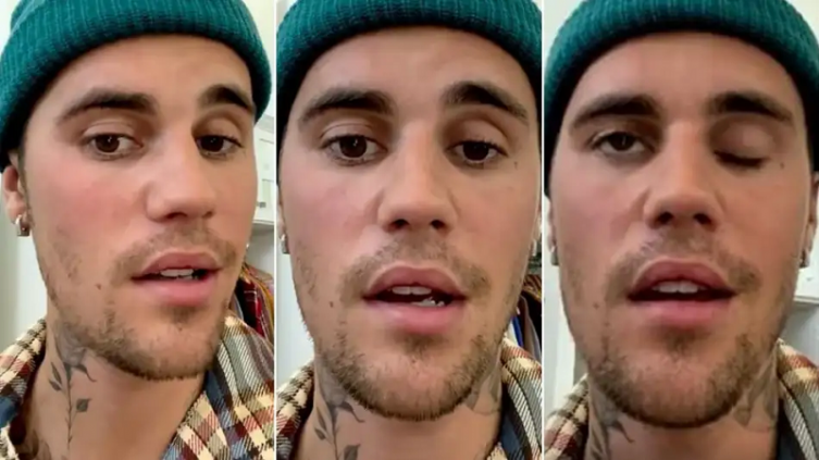 Justin Bieber sufre una parálisis facial tras ser diagnosticado con un raro trastorno: qué tiene - exitoína 
