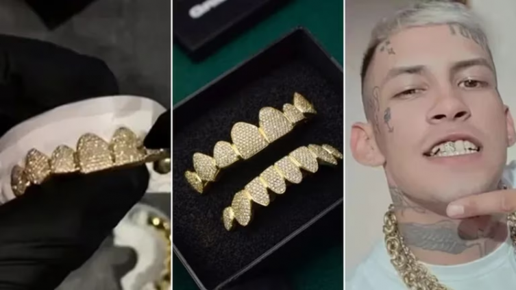L-Gante mostró su nueva dentadura postiza con detalles de oro e incrustaciones de diamante - TELESHOW