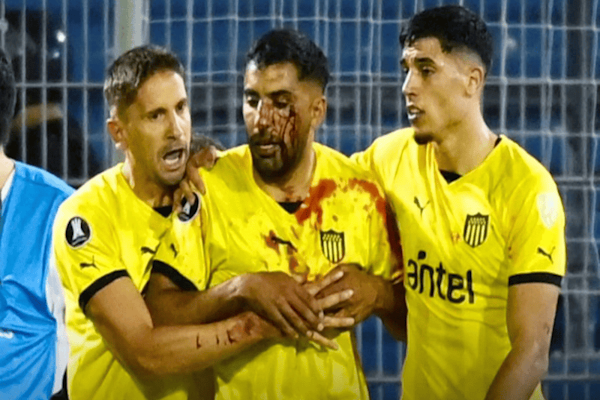 Detuvieron al hincha de Central acusado de haber tirado la piedra que pegó en la cabeza de un jugador de Peñarol - Rosario3