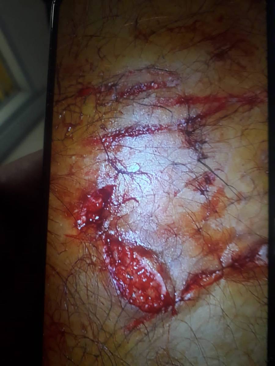 La imagen de las heridas que le provocó el can al efectivo policial.