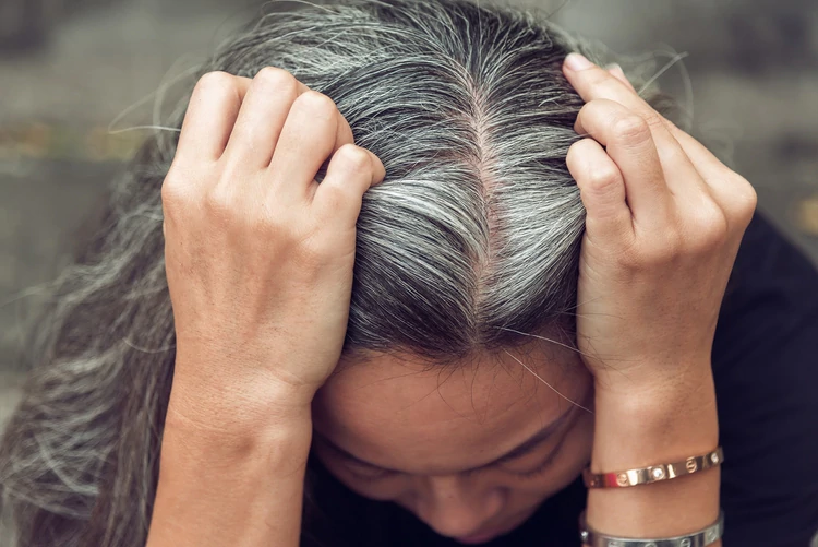 Los científicos confirman que el estrés puede volver el cabello gris (Shutterstock)