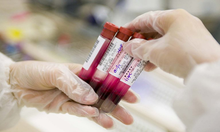 Un tratamiento innovador desarrollado por un equipo israelí podría ofrecer una cura contra este tipo de cáncer de la sangre (Shutterstock)