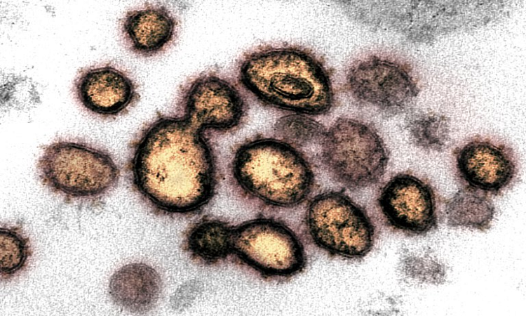 Es probable que haya unos 1,7 millones de virus sin descubrir en la naturaleza, la mitad de los cuales podrían extenderse para infectar a los humanos y desencadenar nuevas pandemias, advirtieron científicos de la ONU (REUTERS)