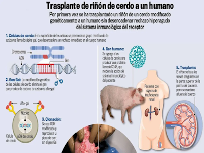 El primer trasplante de riñón de cerdo modificado genéticamente abre las puertas a una fuente alternativa de órganos para humanos - A24